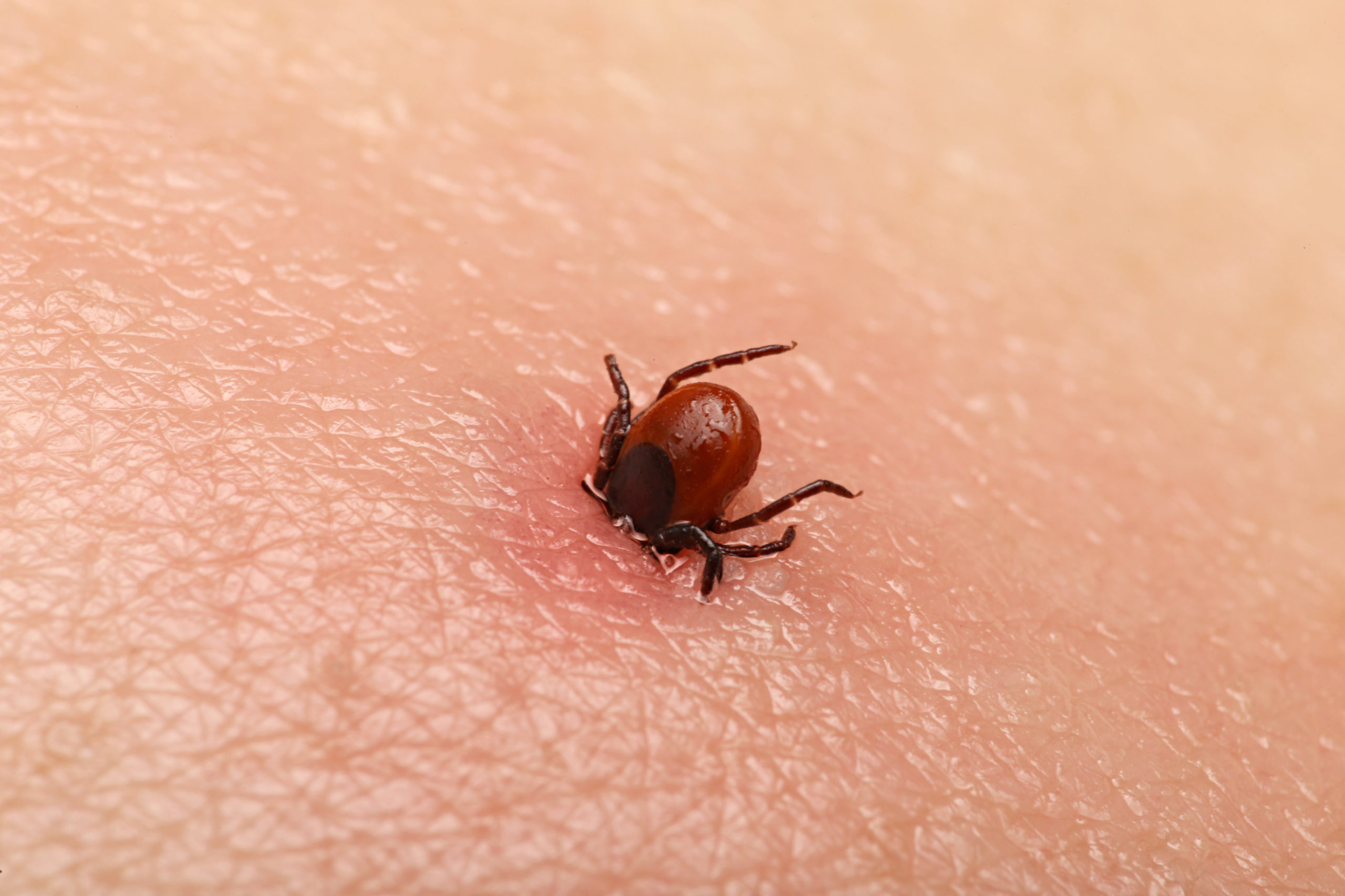 3 Tips for Tick Prevention as Tick Season Approaches